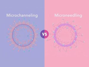 Microchanneling vs. Microneedling: Why Microchanneling Wins for Radiant Skin in Delray Beach, Florida